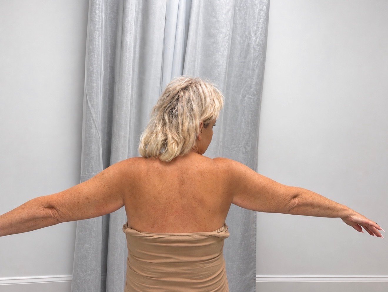 Arm Sculpting before result