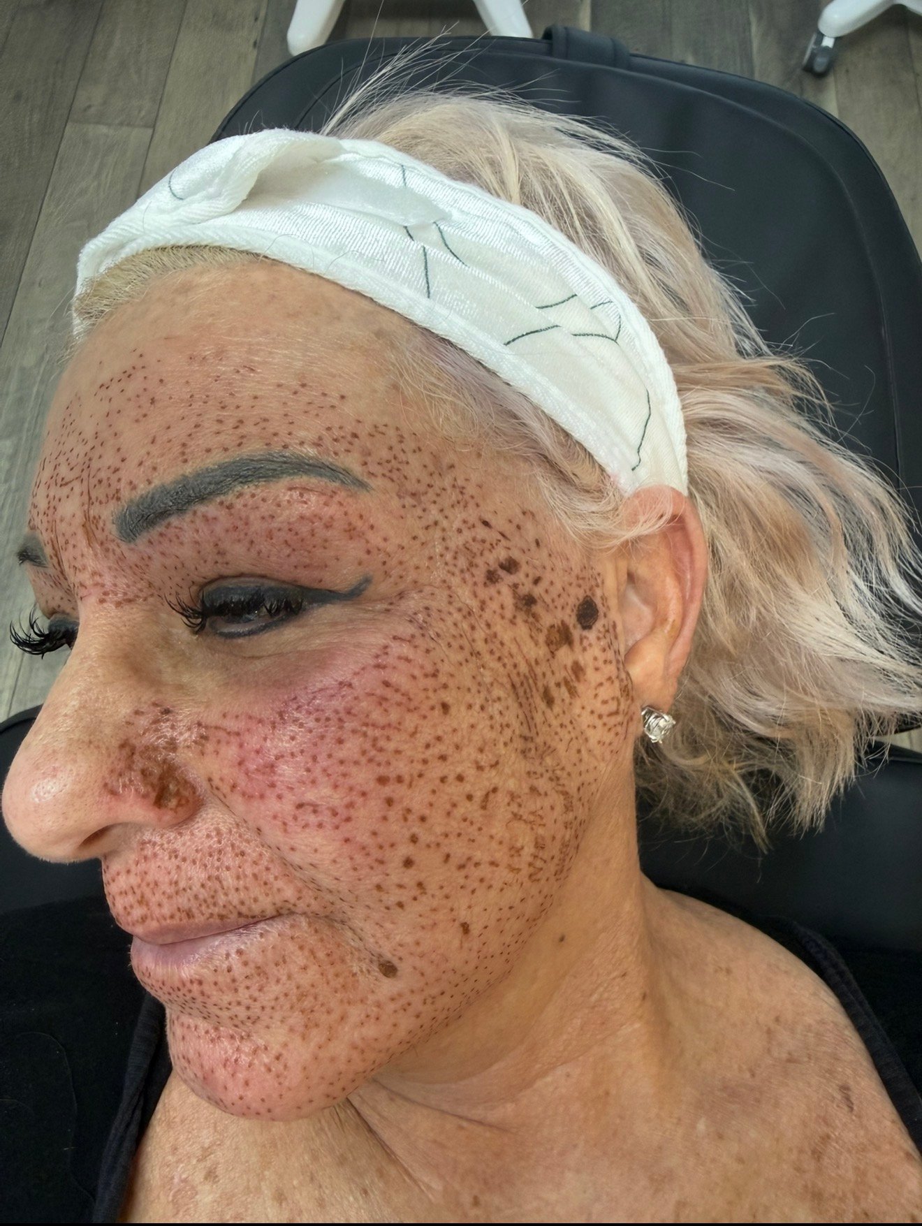 Skin Transformations before result