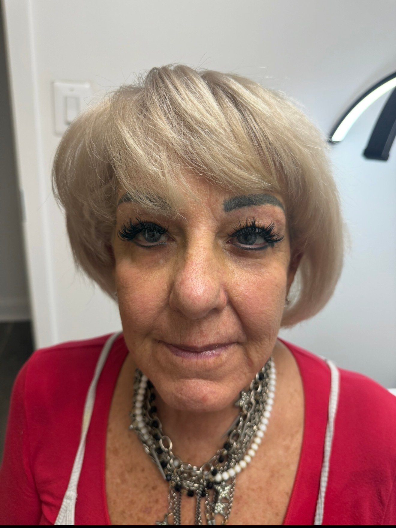 Skin Transformations after result