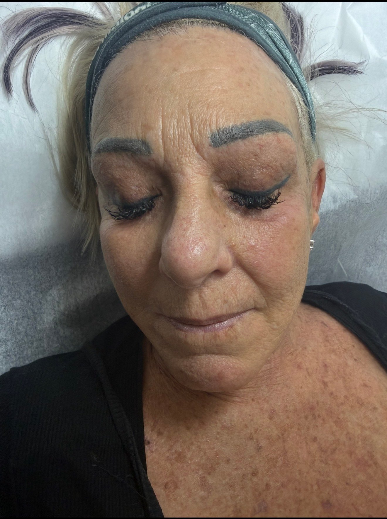 Skin Transformations before result
