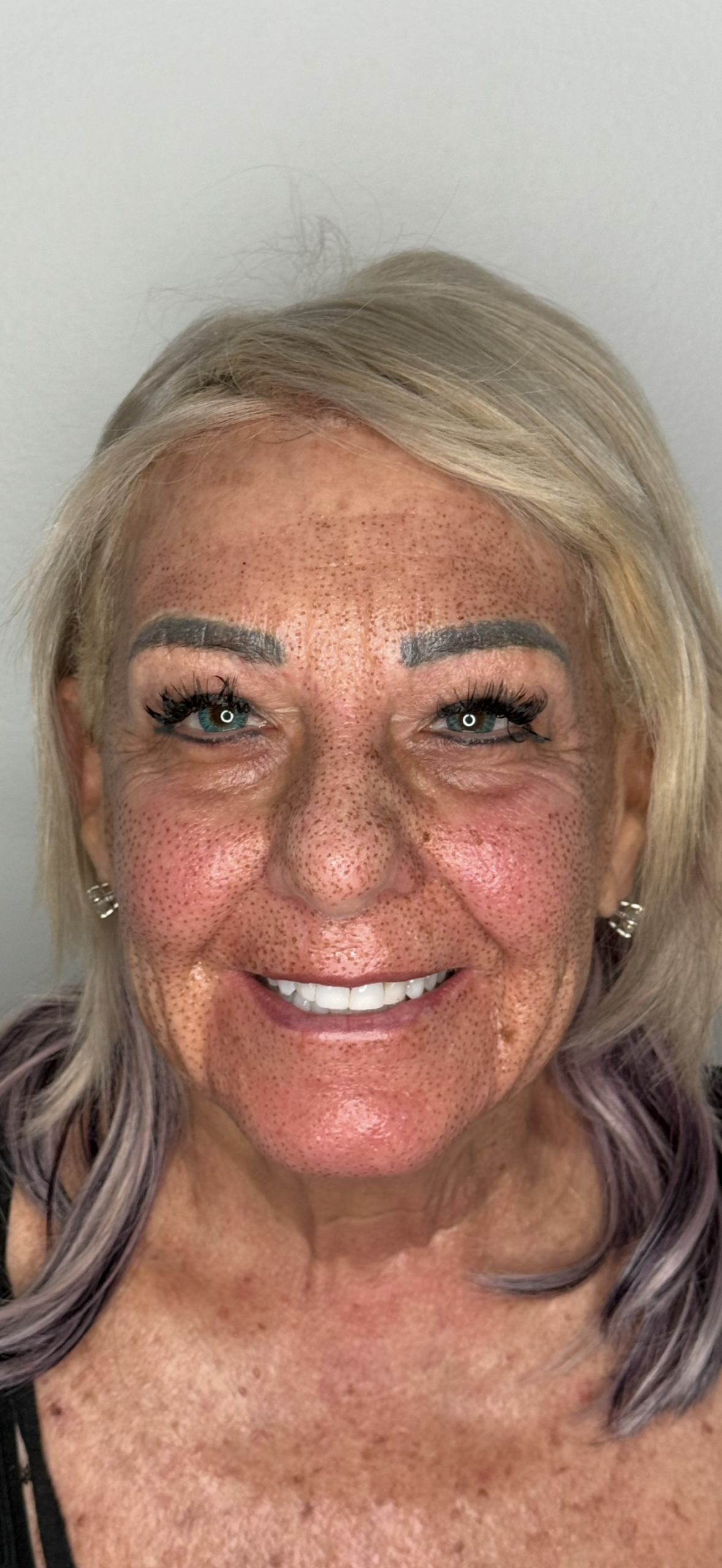 Skin Transformations before result