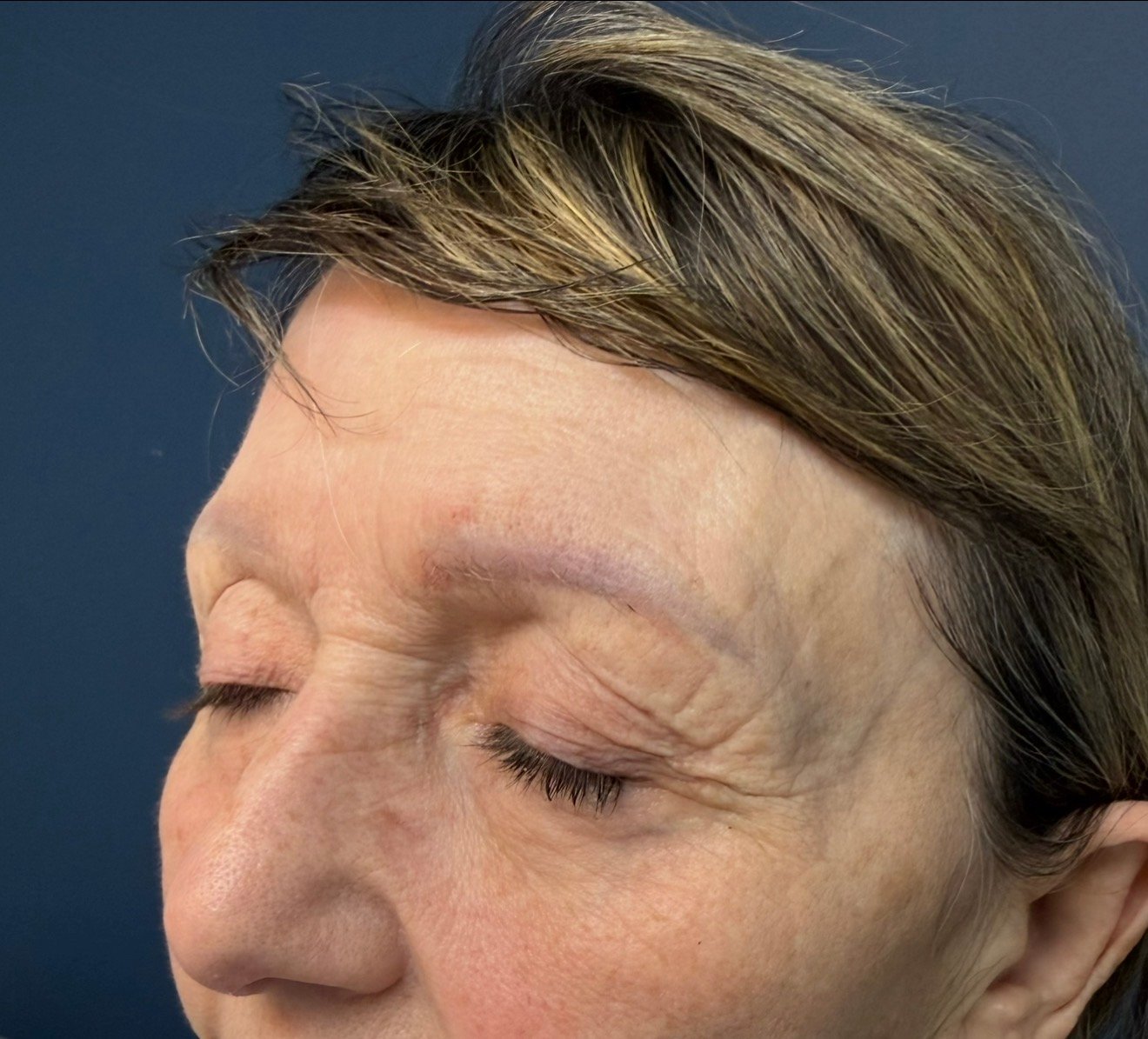 Skin Transformations before result
