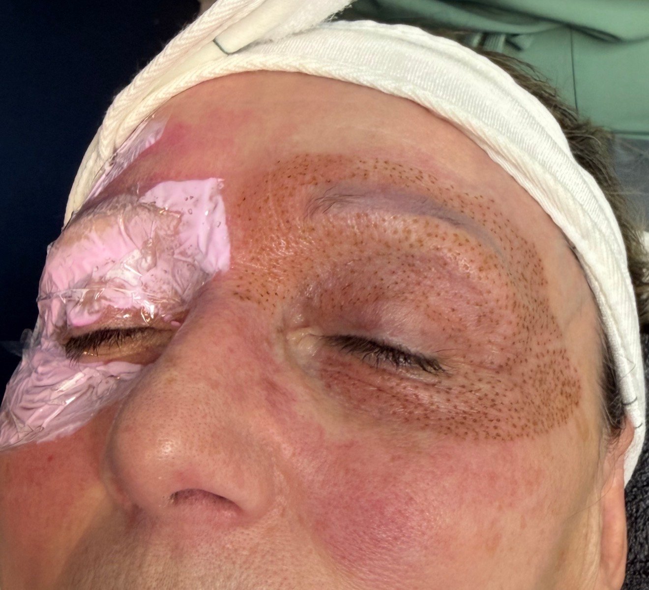 Skin Transformations before result