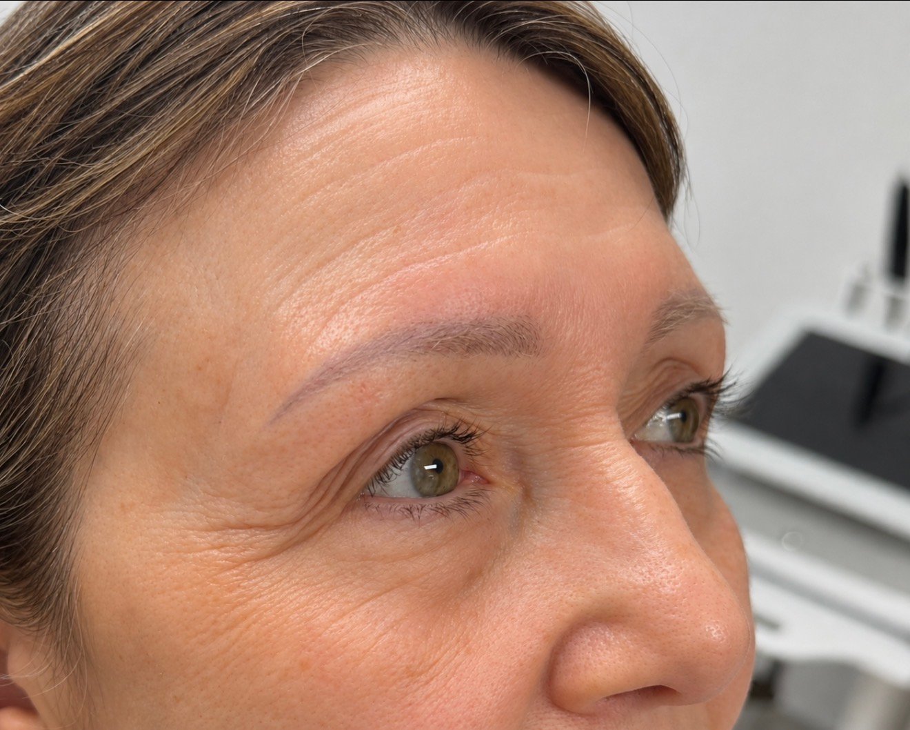 Skin Transformations after result